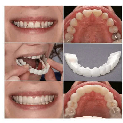 (Paga 1 y lleva 2) Carillas dentales ajustables