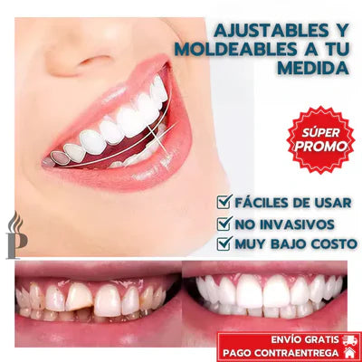 (Paga 1 y lleva 2) Carillas dentales ajustables